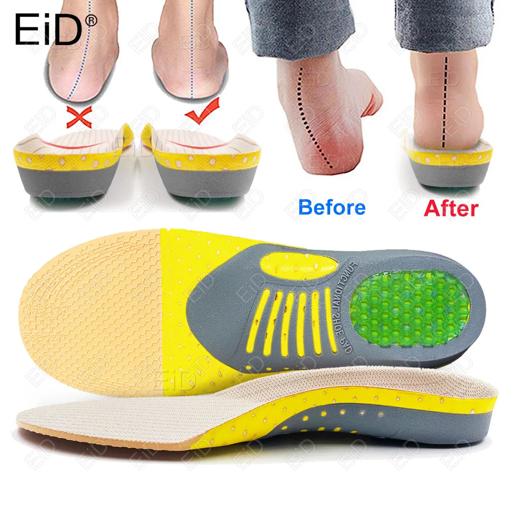 Premium Orthotic Gel Insoles for Flat Foot Support and Plantar Fasciitis Relief - Unisex Arch Support Shoe Inserts